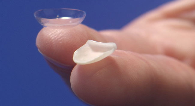 Lente de Contato Dental Lente de Contato Dental