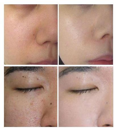 BB Cream